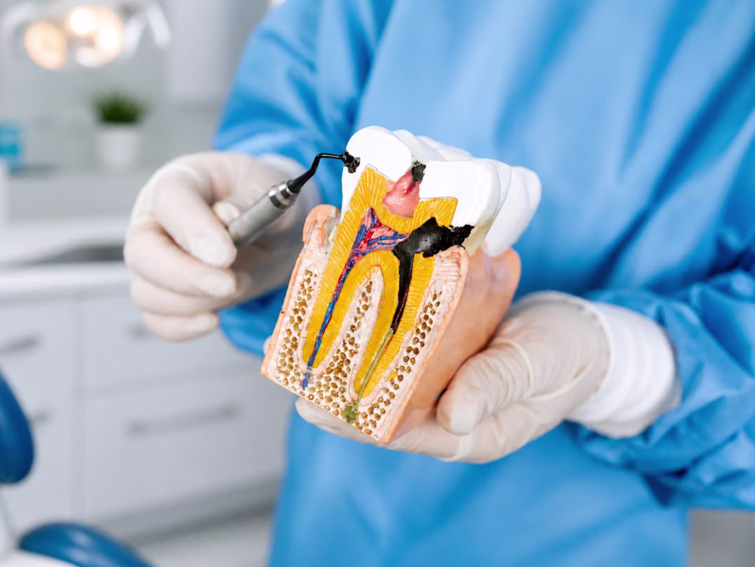 Restorative dental treatment